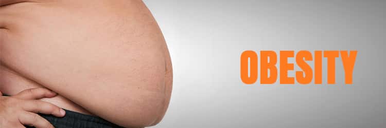 Obesity